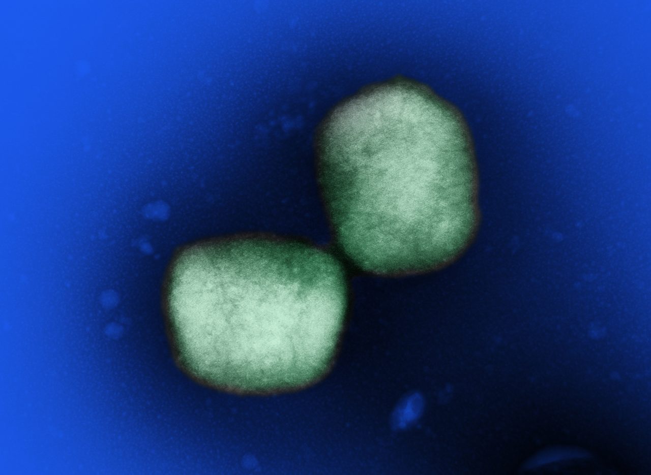 A colorized transmission electron micrograph showing two green mpox virus particles against a blue background.
