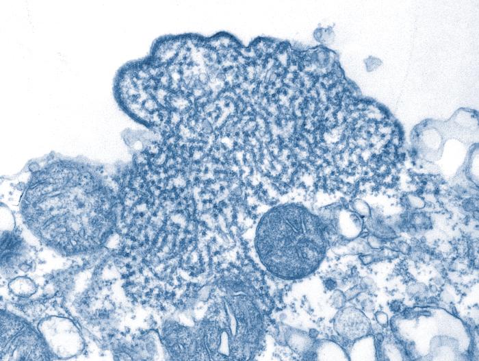 Transmission electron micrograph showing Nipah virus virions isolated from a patient